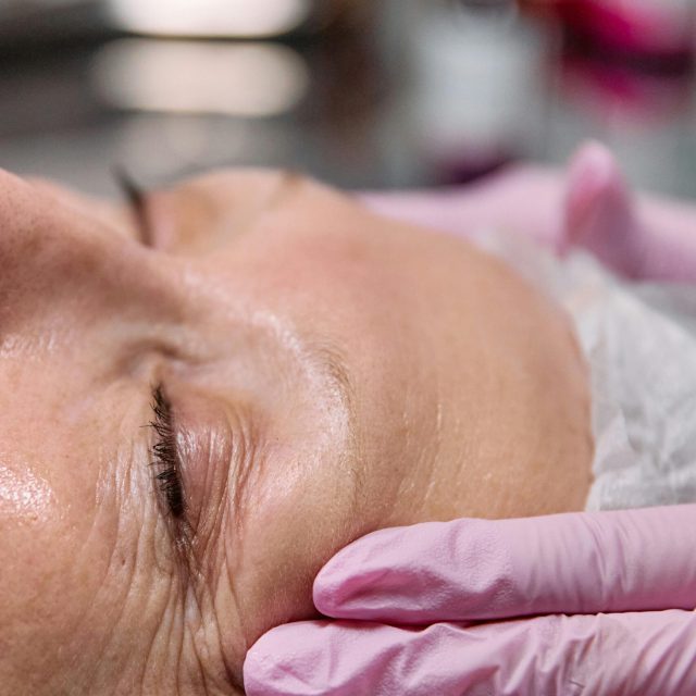 Eine Nahaufnahme des Gesichts einer Person mit geschlossenen Augen, die glatte Haut und leichte Falten zeigt. Handschuhe berühren sanft die Wange, was auf Prävention oder Hautpflege in einem klinischen Umfeld hindeutet.